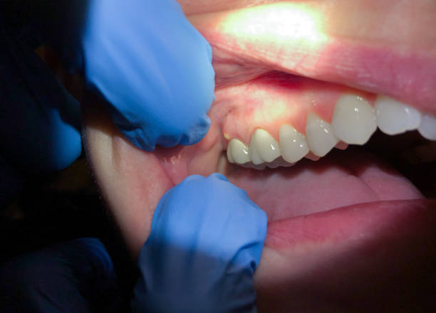 Best Emergency TMJ Treatment in Fair Plain, MI