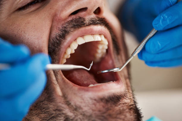 Best Emergency Dental Care for Broken or Chipped Teeth in Fair Plain, MI